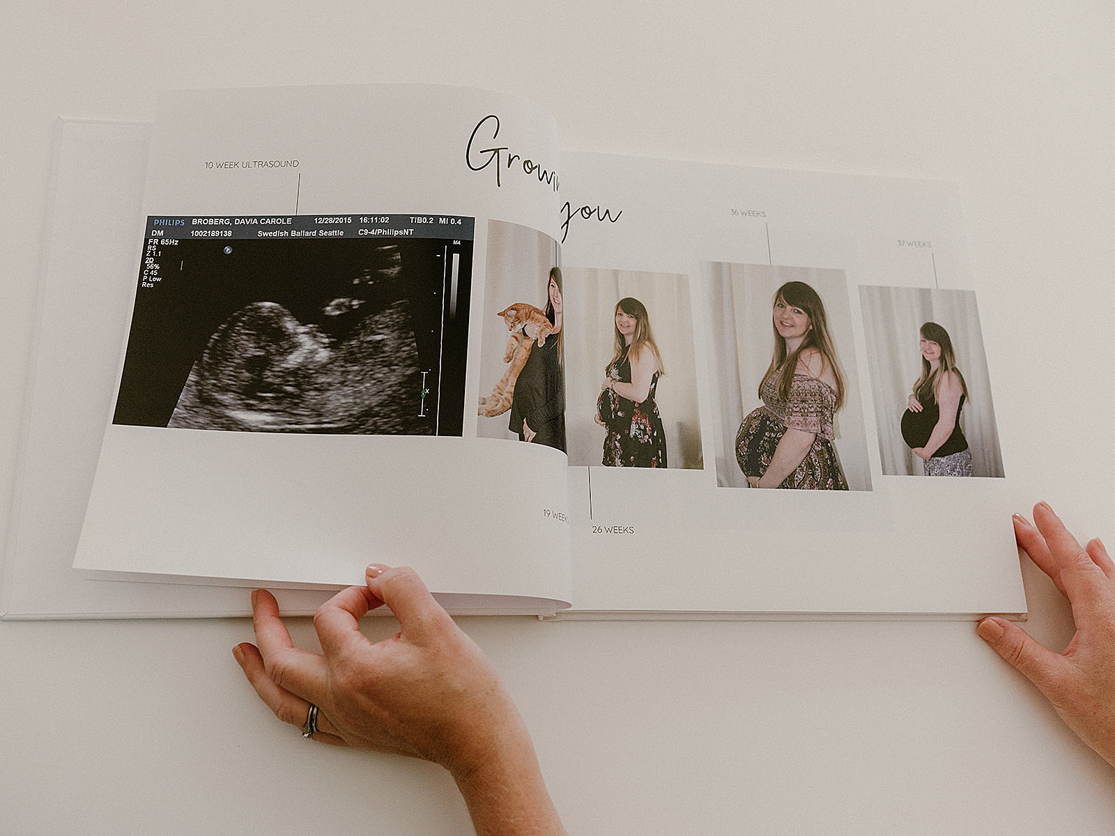 A woman flips through pregnancy photos in a baby book.